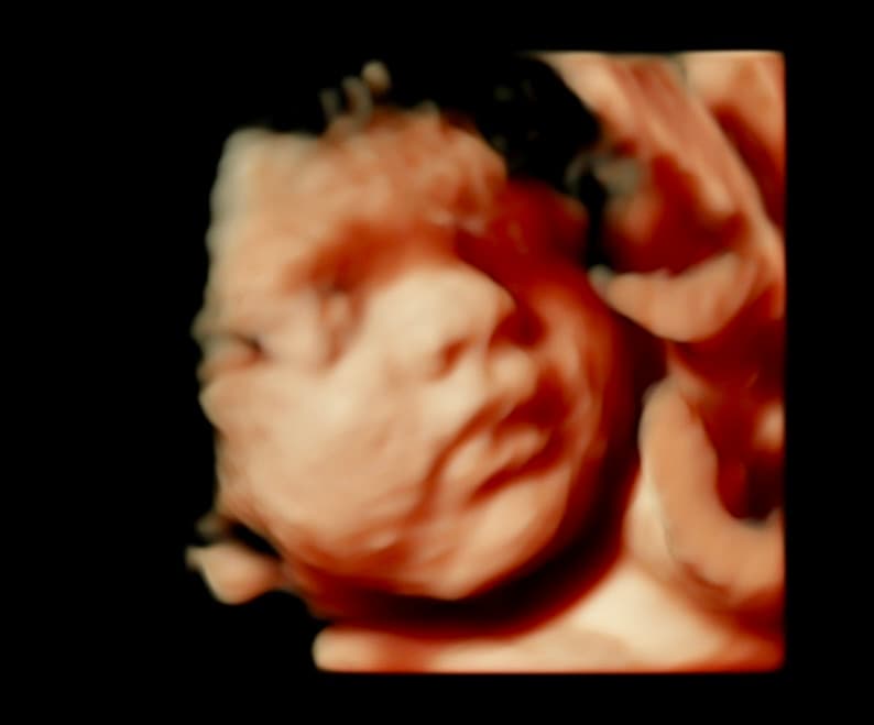 Gallery 3D-orange-1.jpeg